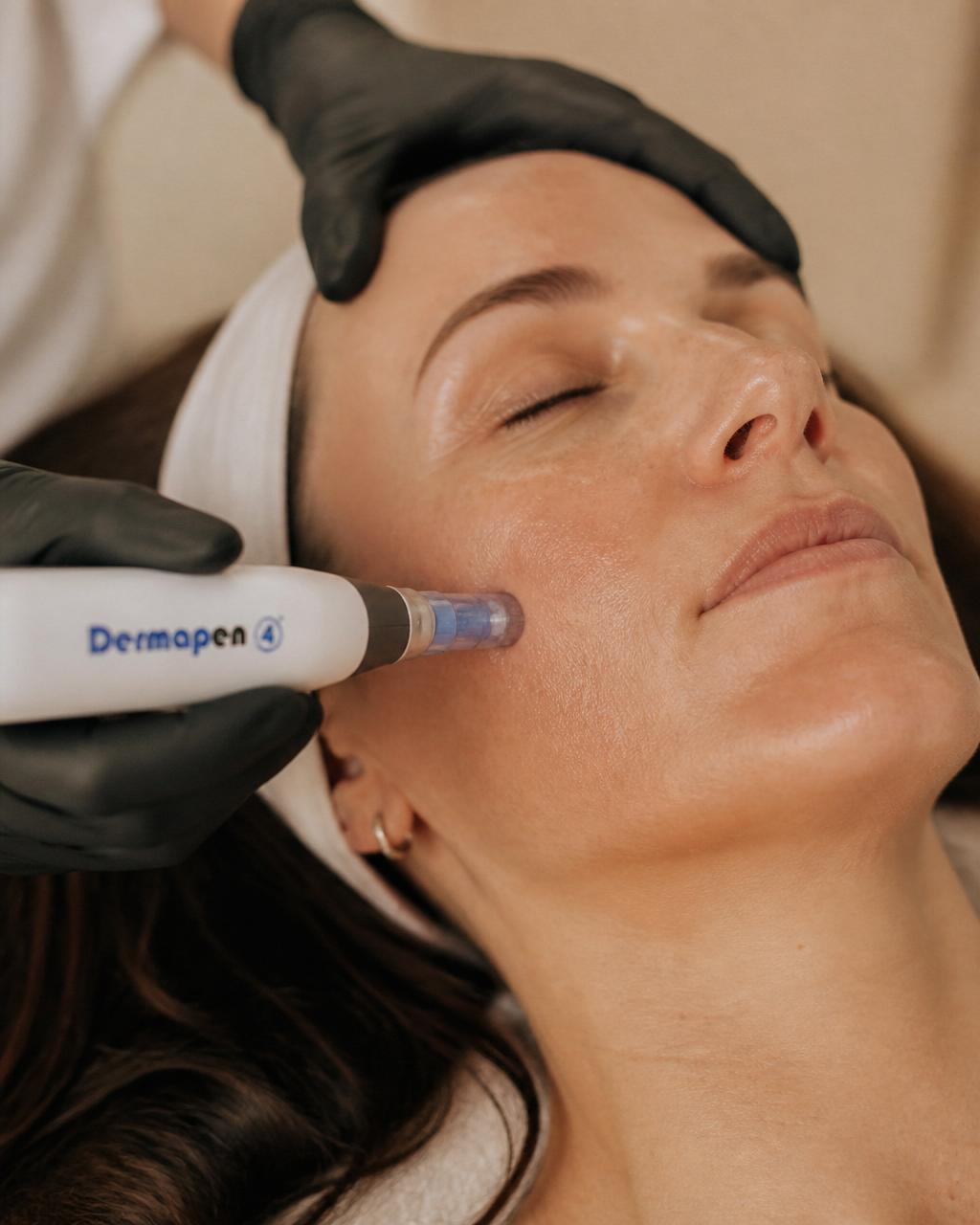 Microneedling dermapen 4